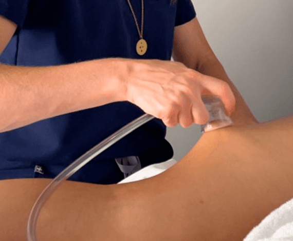 Therapist guiding the DermaShape device